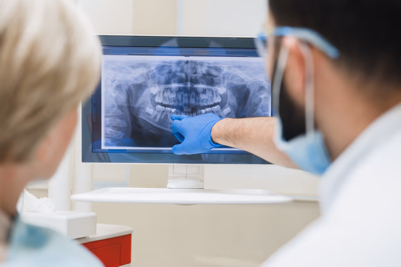 Crowns After Root Canal: Why They’re Essential for Recovery